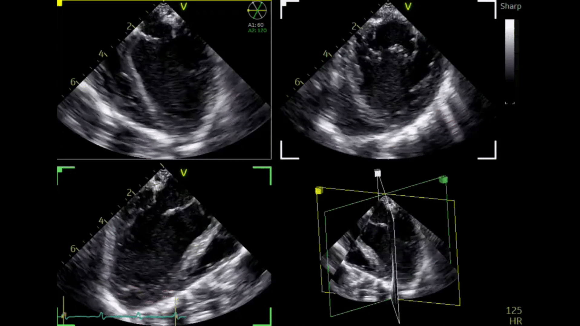 Vivid E Series Ultrasound Systems GE HealthCare (2).gif