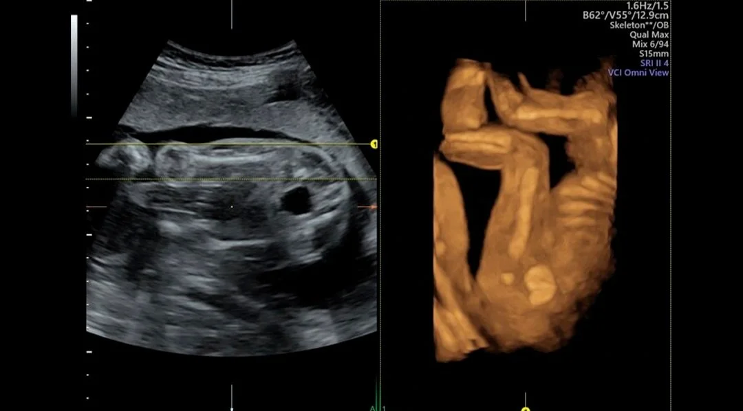 Imagen clinica 12.jpg