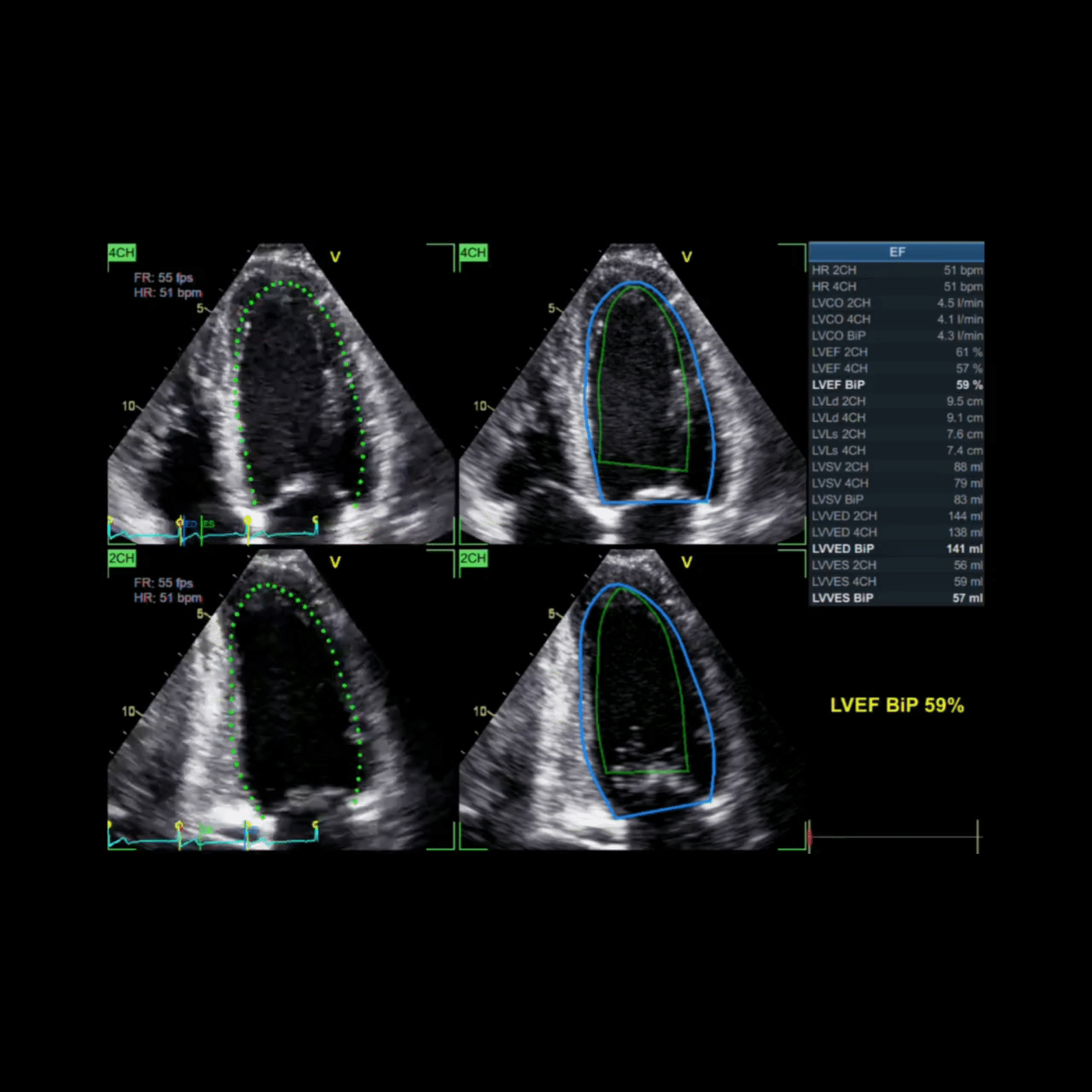Message from GE HealthCare.gif