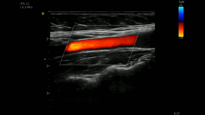 Vivid iq Ultrasound System GE HealthCare.gif