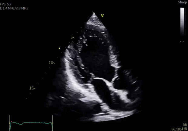 Vivid iq Ultrasound System GE HealthCare (1).gif