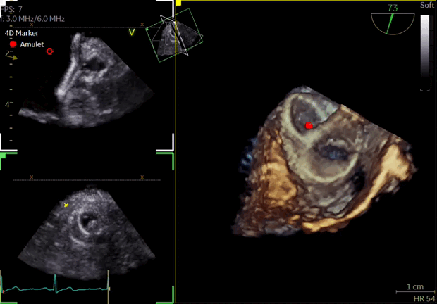 Vivid S Series Ultrasound Systems GE HealthCare (3).gif