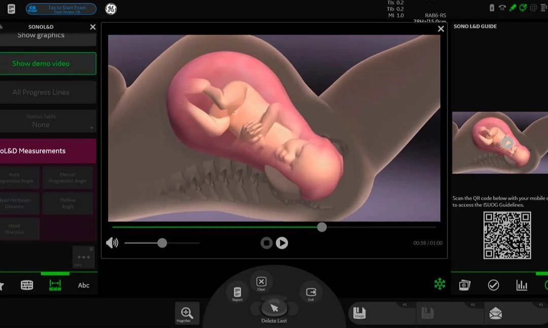 SonoL&D Measurement Guide.jpg