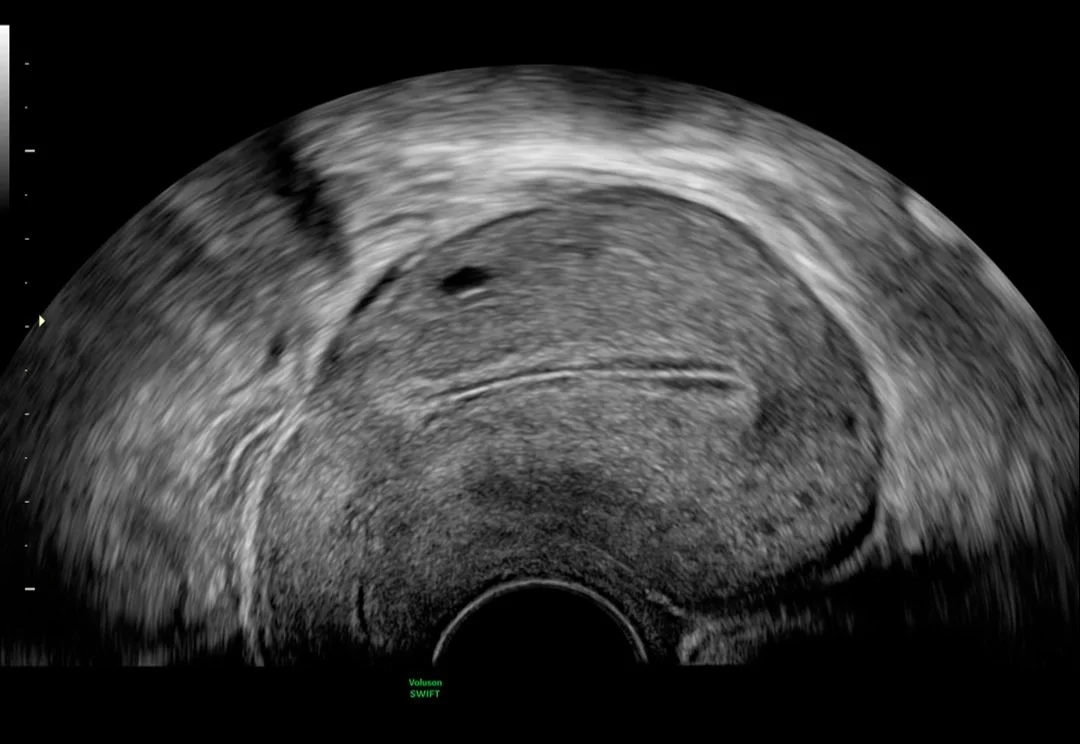 Utero.jpg