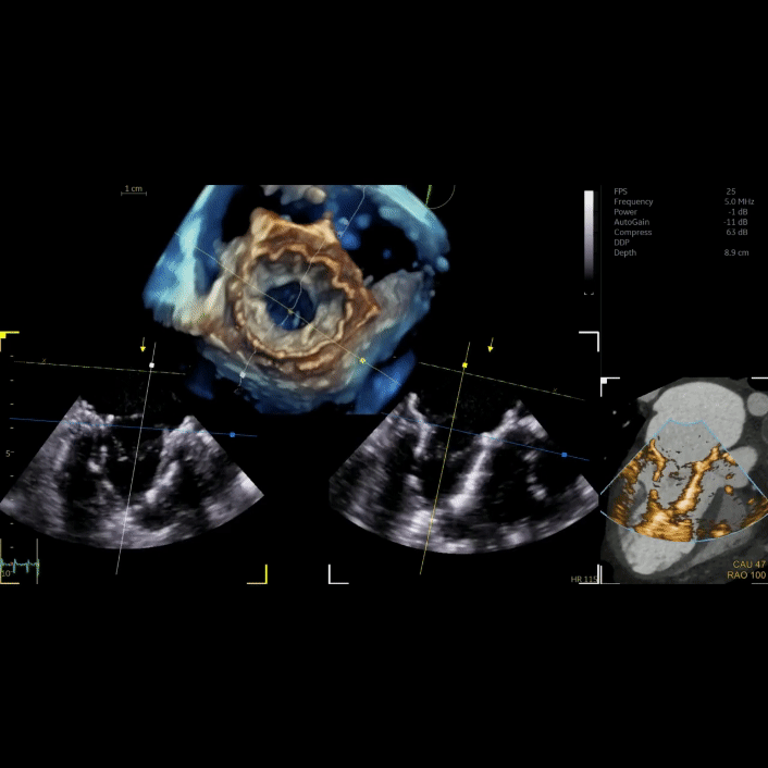 Vivid E Series Ultrasound Systems GE HealthCare (3).gif