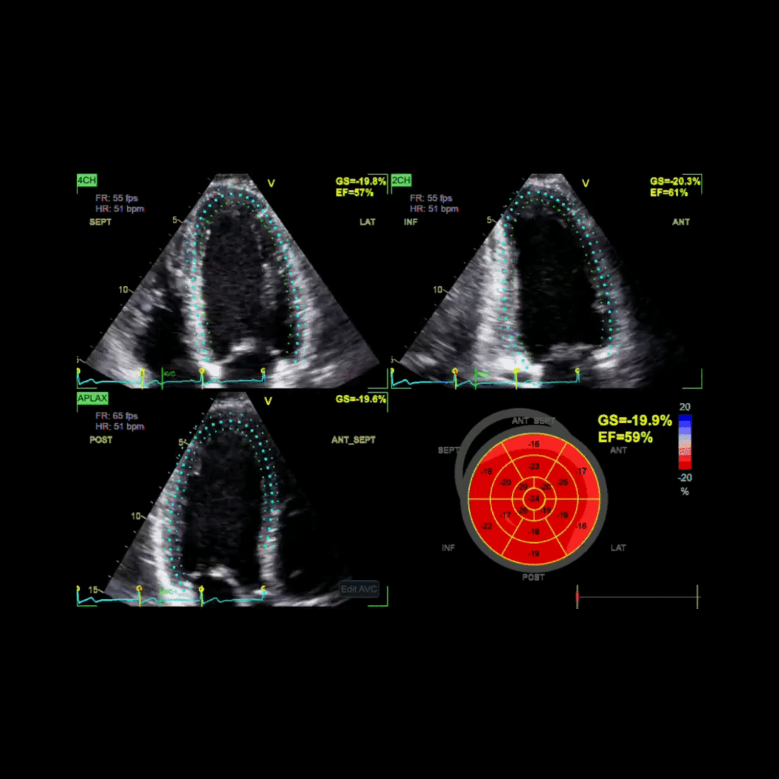 Vivid E Series Ultrasound Systems GE HealthCare (1).gif
