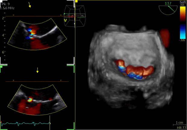 Vivid S Series Ultrasound Systems GE HealthCare (2).gif