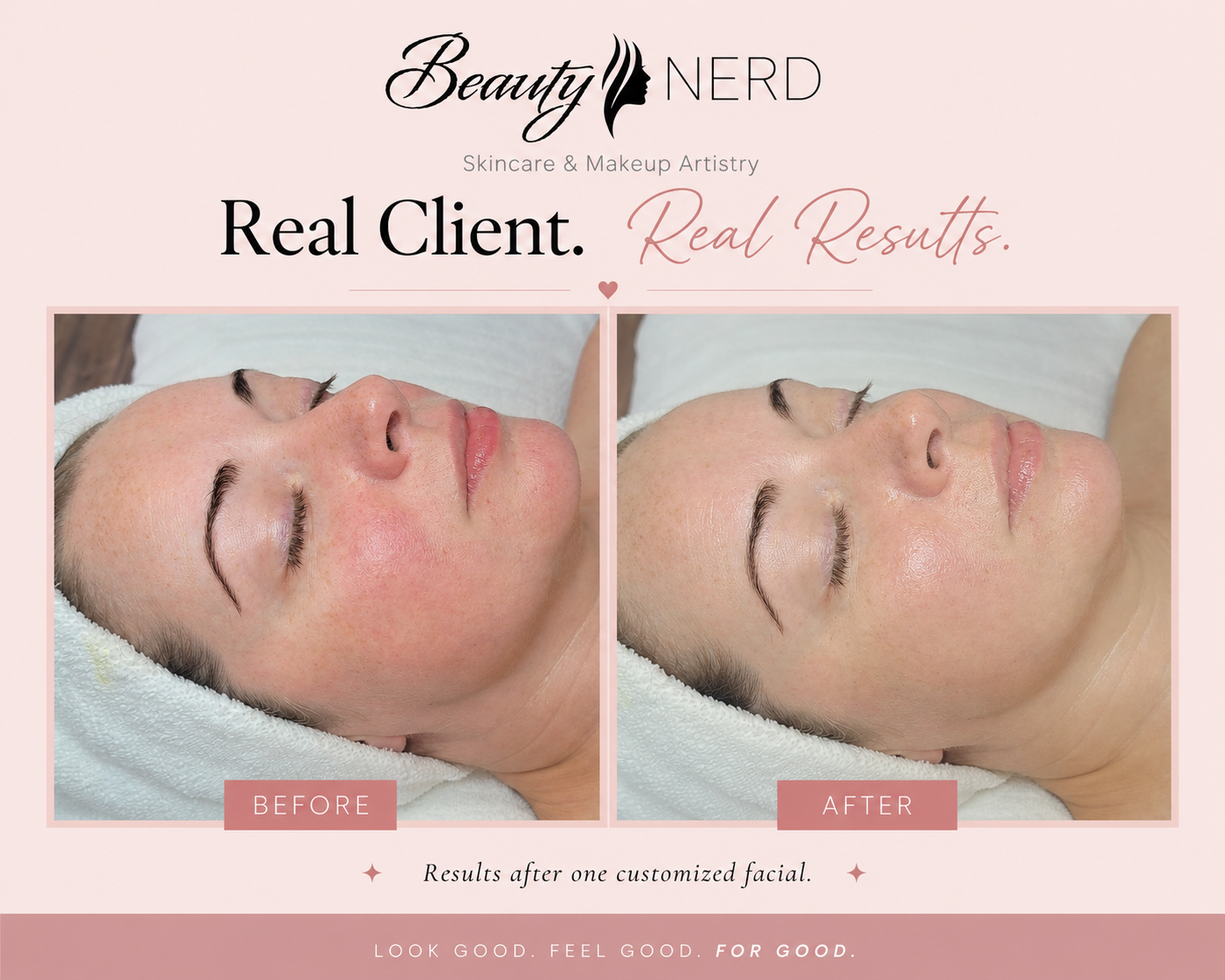 A promotional graphic showing before and after photos of a woman who received a facial treatment. The left side labeled "BEFORE" shows her with redness and uneven skin tone, while the right side labeled "AFTER" shows clear, glowing skin. The text reads "Beauty Nerd, Skincare & Makeup Artistry, Real Client, Real Results," with a tagline "Results after one customized facial." The bottom has the phrase "Look good. Feel good. For good."