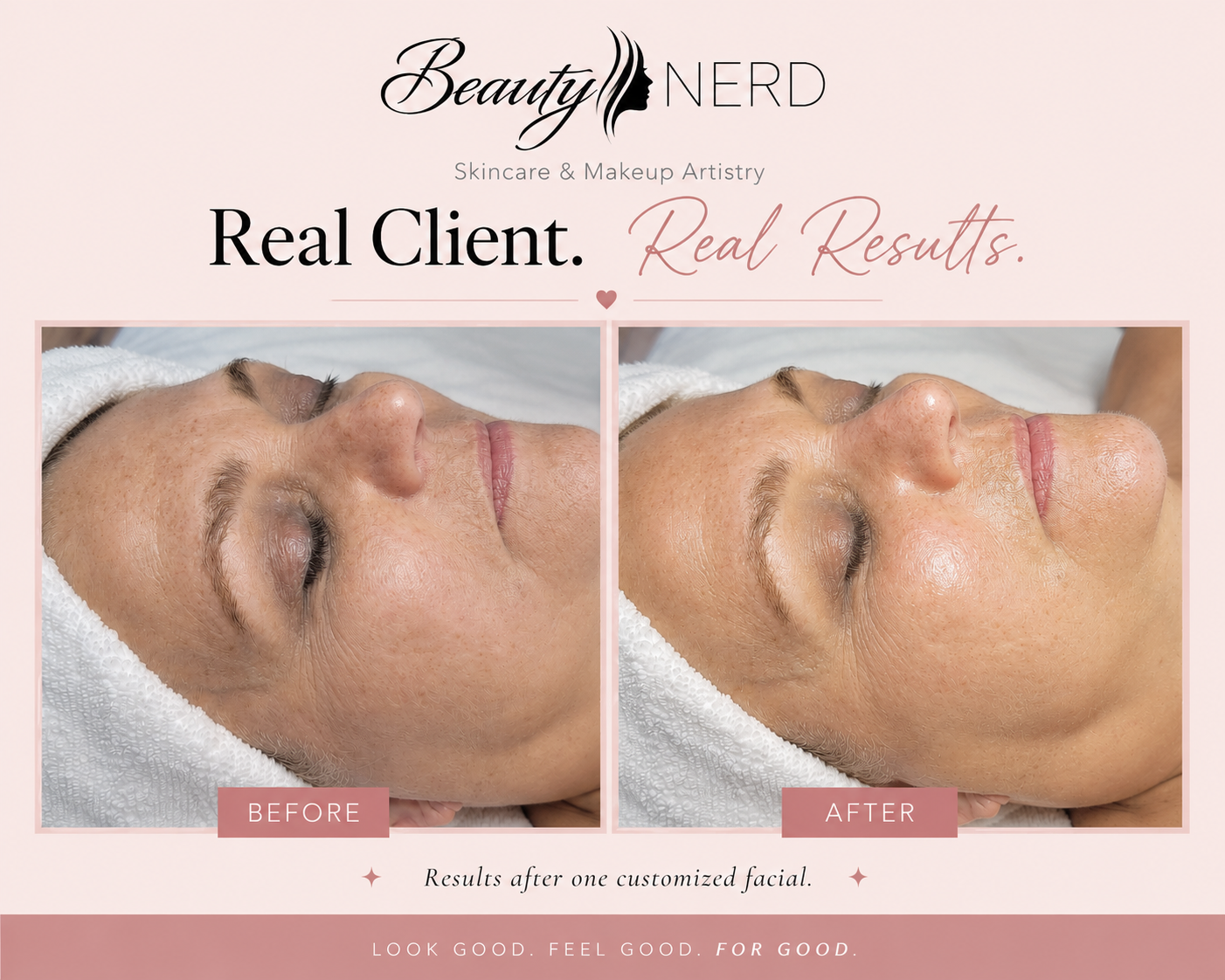 Comparison of a woman's face before and after a facial treatment, showing smoother skin and reduced signs of aging.