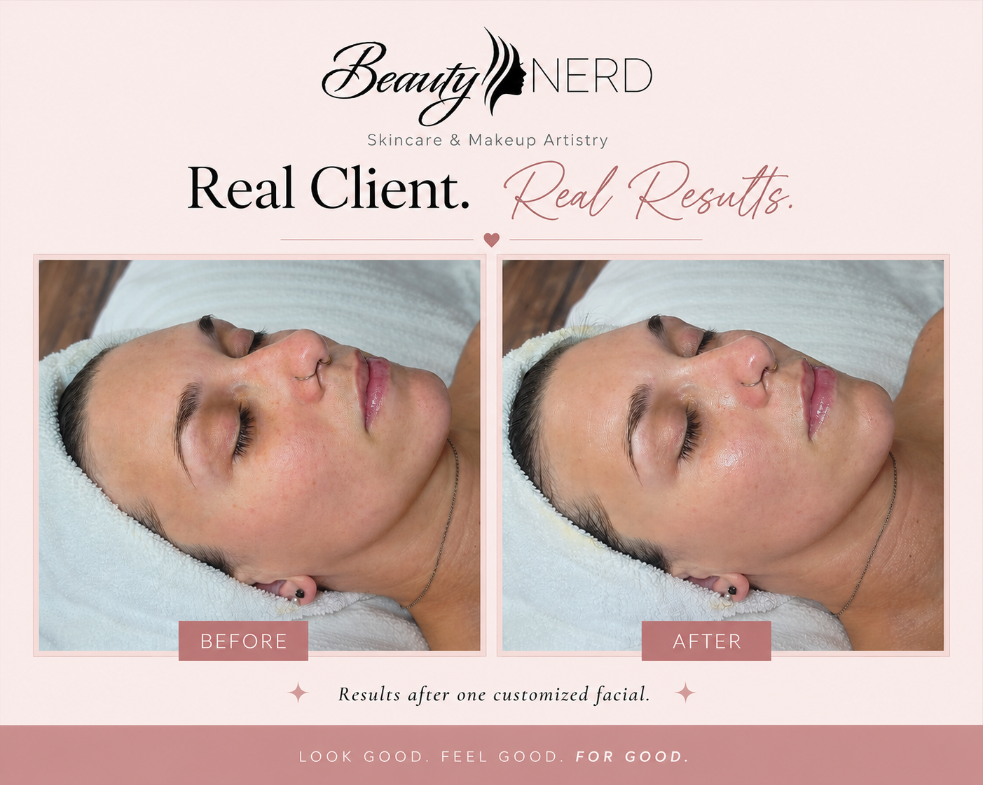 Side-by-side comparison of a woman's face before and after a facial treatment, showing improved skin clarity and glow, with text indicating 'BEFORE' and 'AFTER' results at the bottom of each photo.