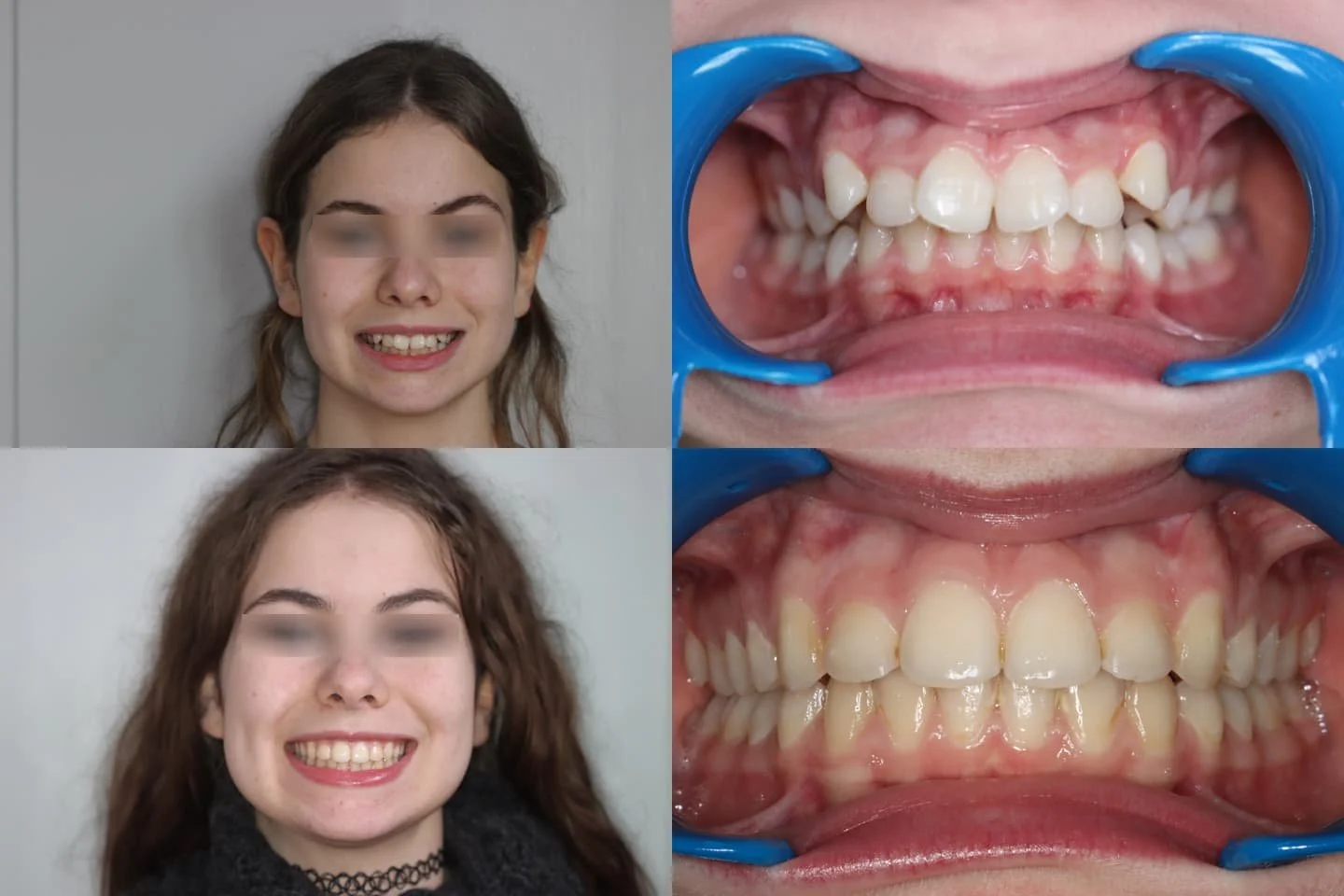 TRAITEMENT RÉALISÉ PAR MULTI-ATTACHES