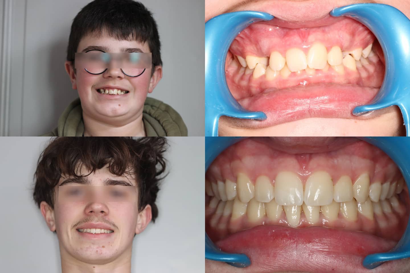 TRAITEMENT RÉALISÉ PAR MULTI-ATTACHES