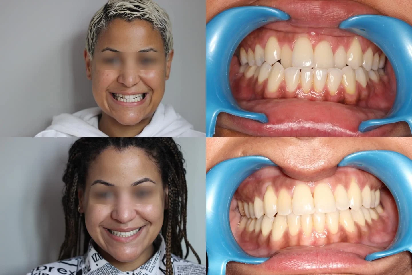 TRAITEMENT RÉALISÉ PAR MULTI-ATTACHES