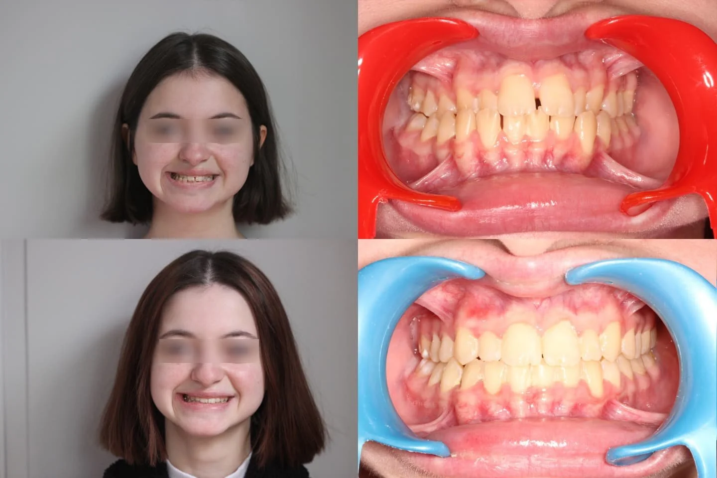 TRAITEMENT RÉALISÉ PAR MULTI-ATTACHES