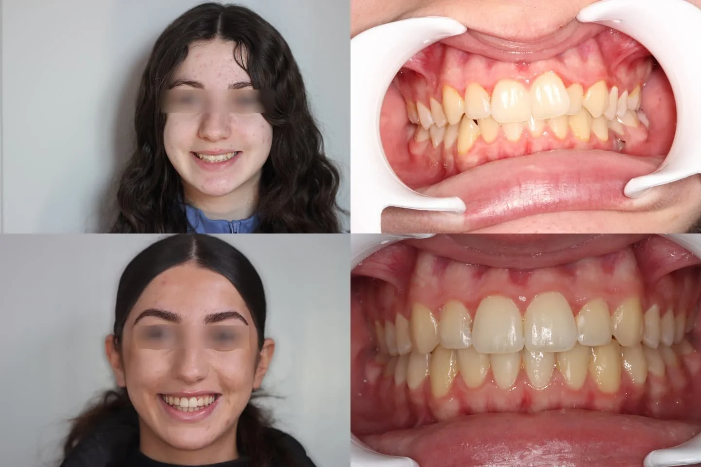 TRAITEMENT RÉALISÉ PAR MULTI-ATTACHES