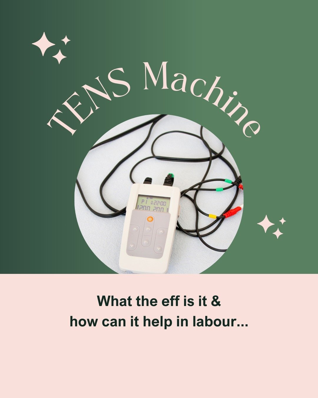 🌟 Let's talk about TENS machines in labor! 🌟

Have you considered using or used a TENS machine during childbirth? Share your experiences in the comments below! 💬

Personally, I haven't tried one yet, but I've heard mixed reviews in regards to peop