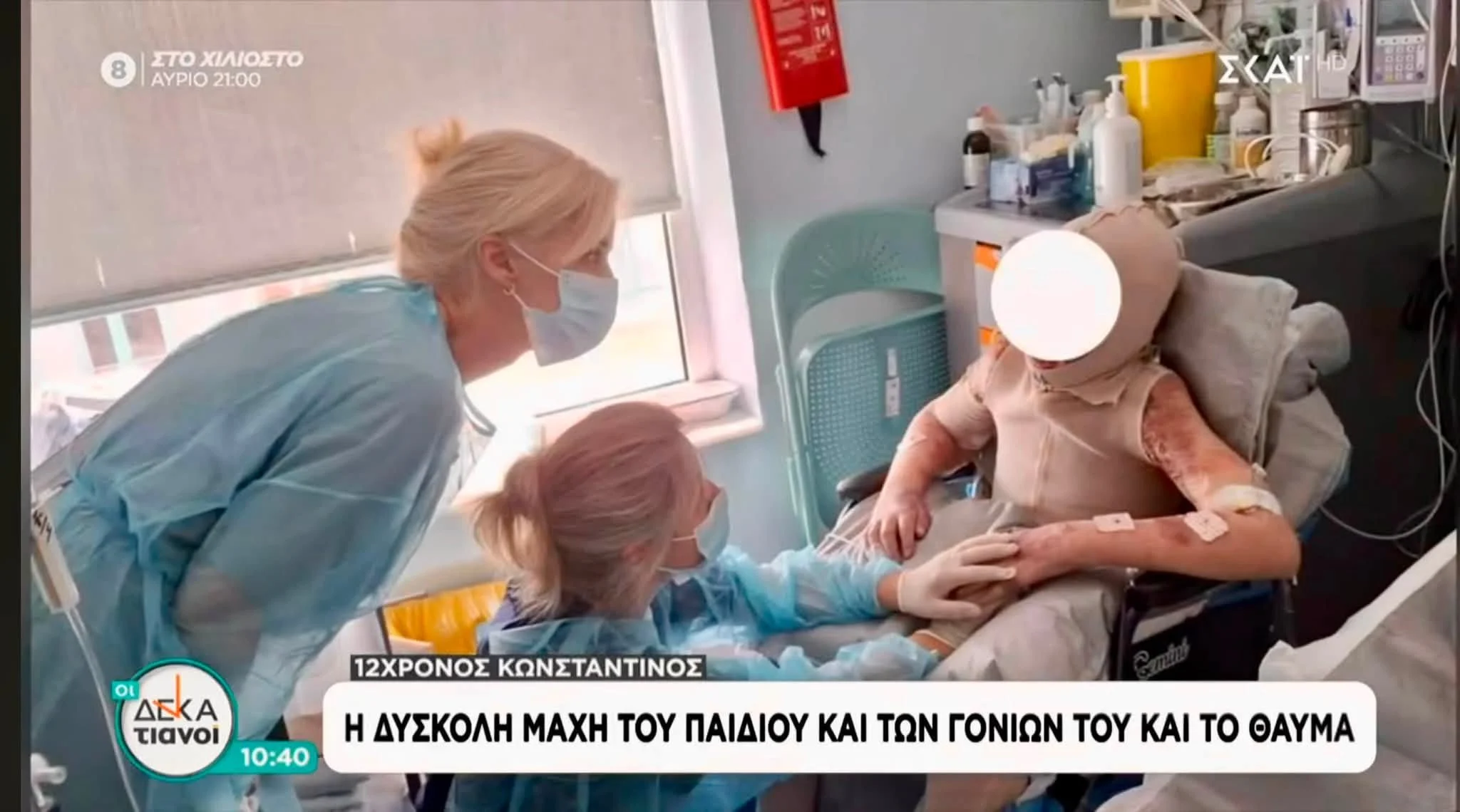 Θετικά νέα για τον 12χρονο που είχε εγκαύματα στο 90% του σώματός του