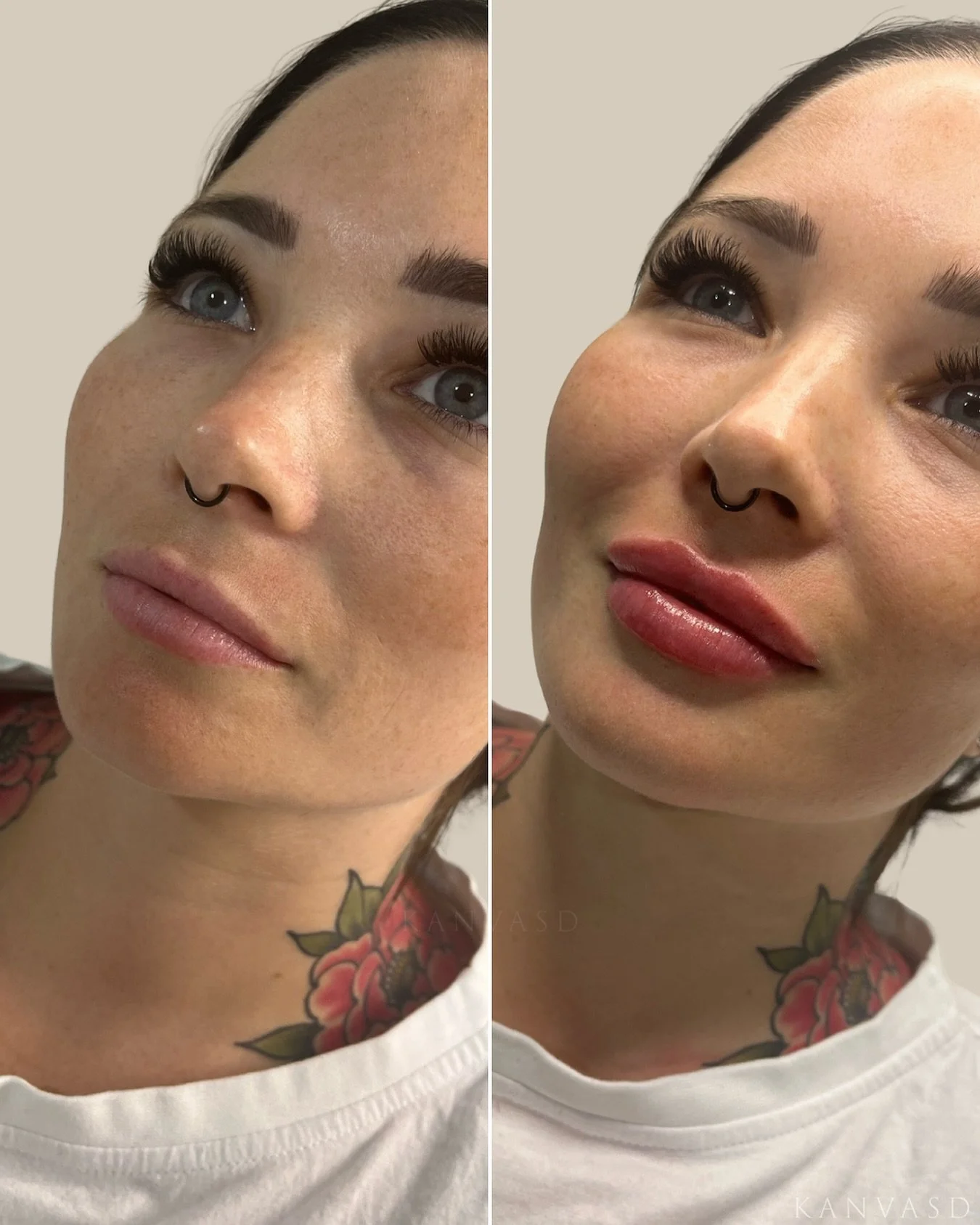 At Kanvasd Clinic, our focus is on refined, personalised results achieved through a deep understanding of your skin and aesthetic goals. 

Instagram: @kanvasdclinic 
Email: info@kanvasd.com.au
Location: 172 Gympie Road Kedron 
www.kanvasd.com.au

#ka