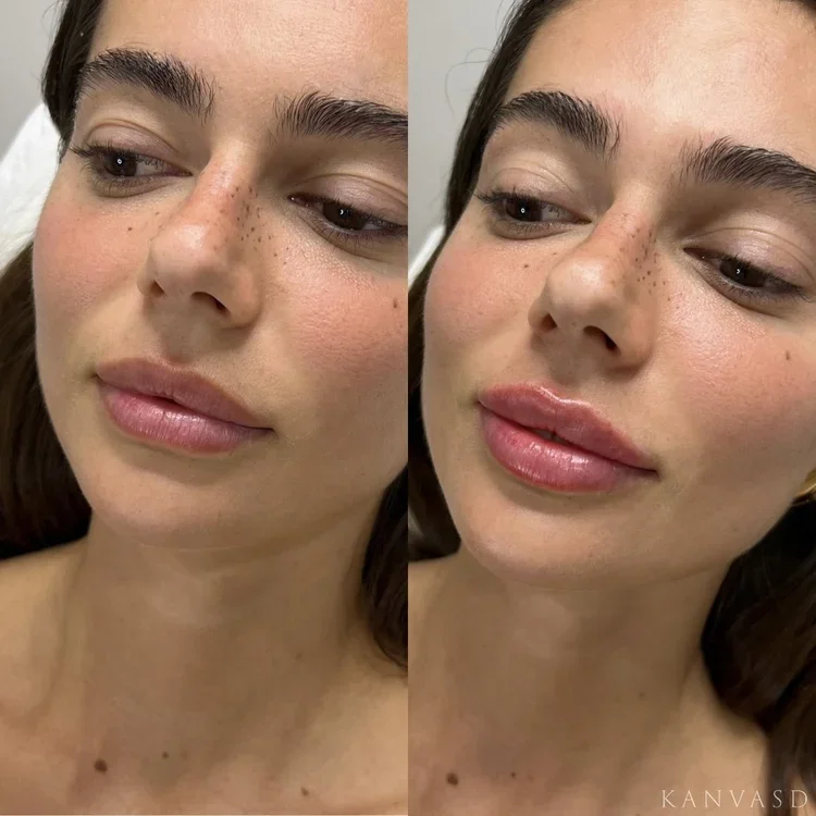 Volume Replacement Consultations