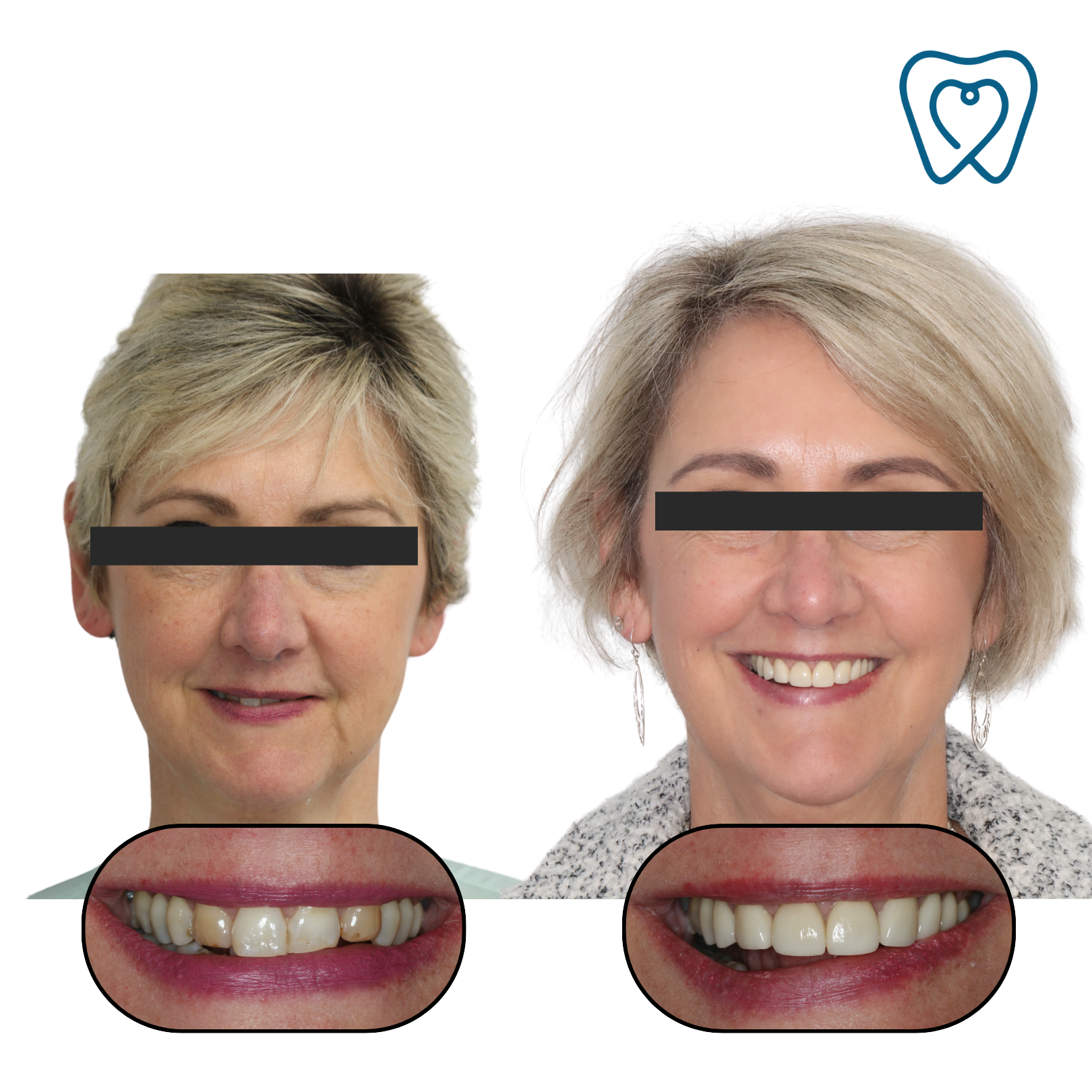 Before and after templates .png