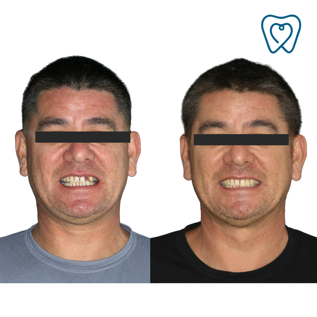 Beige Minimalist Skincare Before and After Instagram Post-11.png