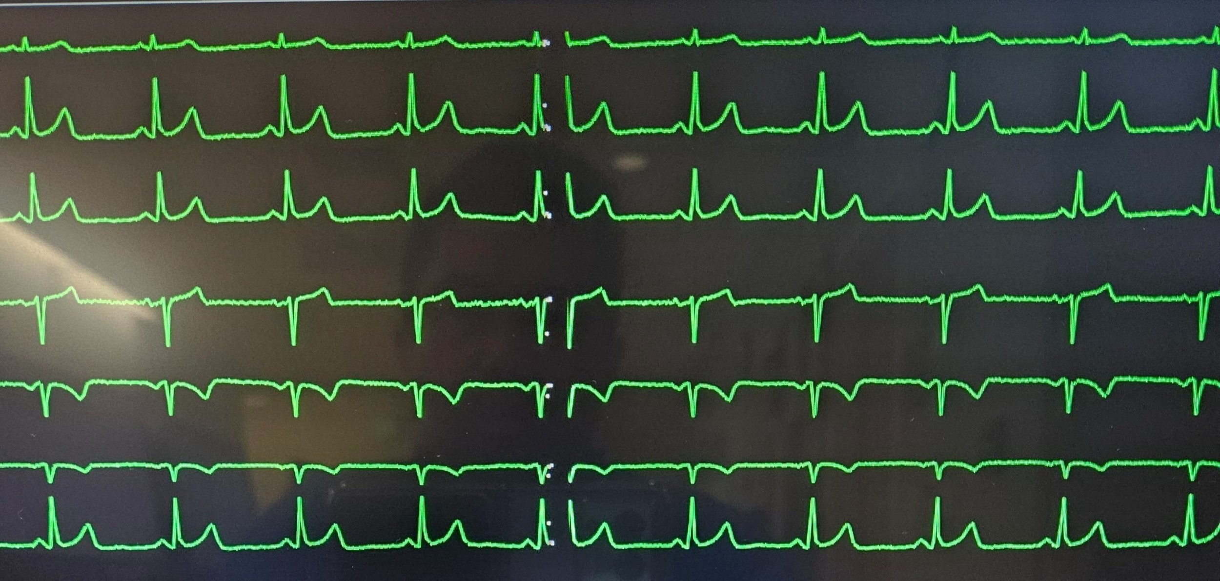 EKG.jpg