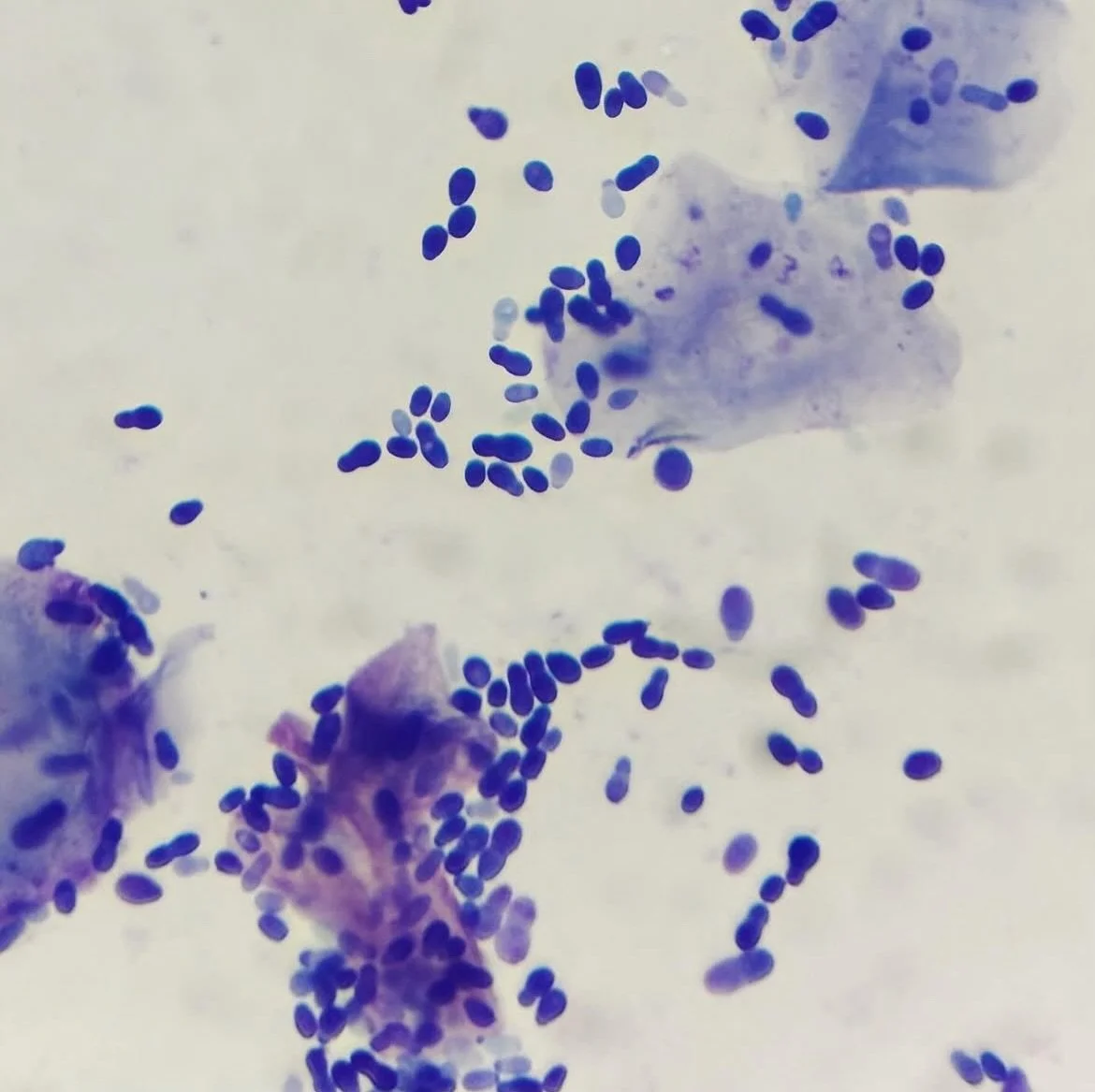 Y is for yeast! Yeast is a spore-like fungus that is commonly found on our pets! You can find a small amount of yeast on skin most of the time, which does not necessarily cause an issue. But when it overgrows it can cause trouble.
Yeast infections ar