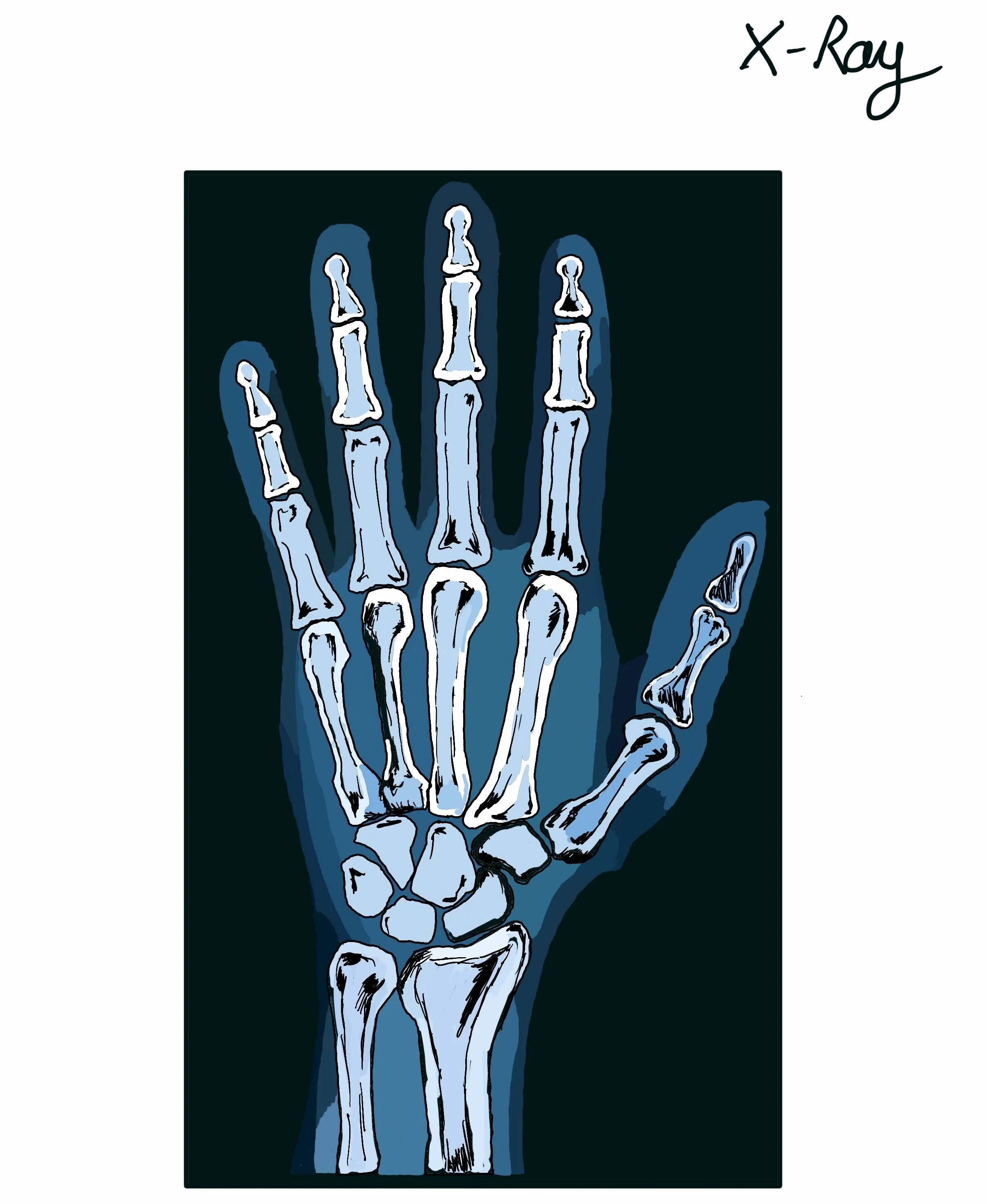 X ray.jpeg