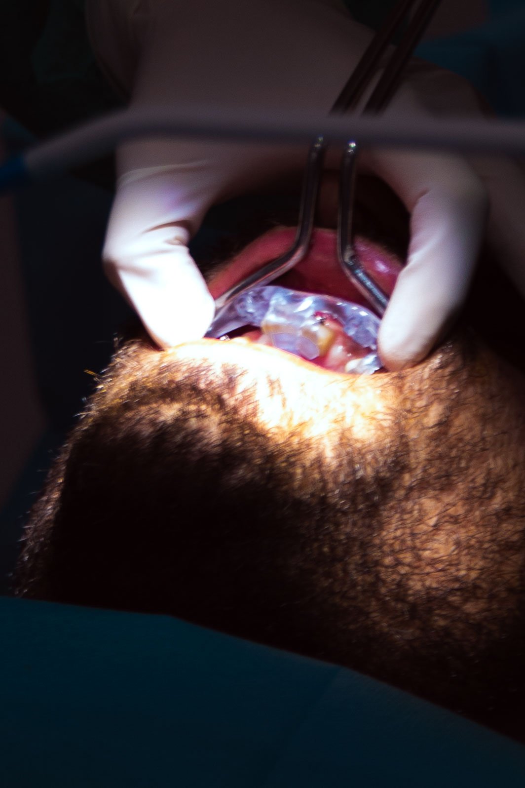 Semplicità di uso e precisione