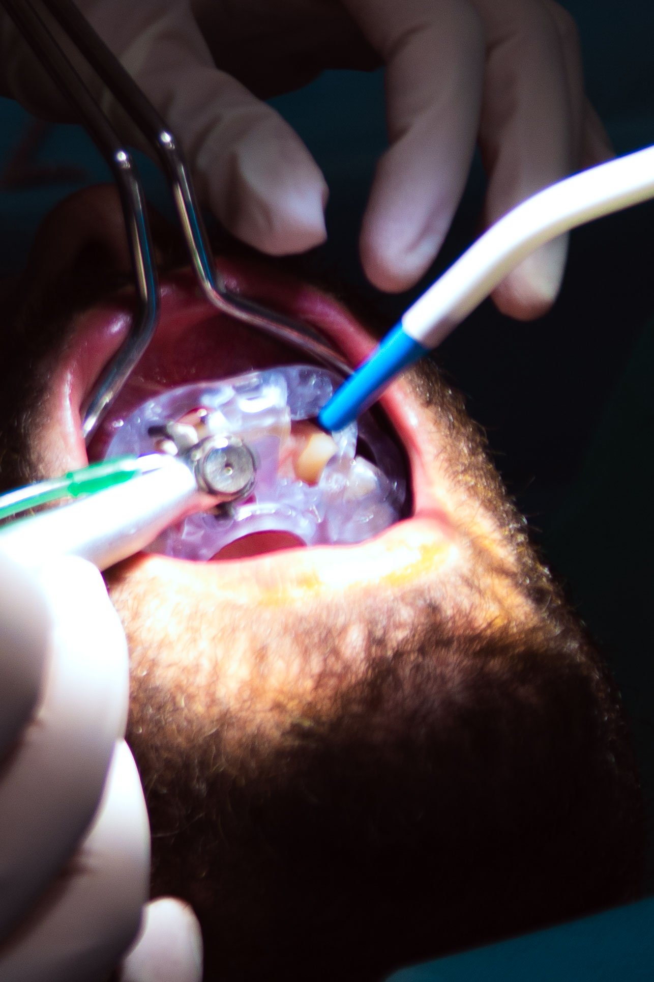 Nessuna Boccola. Guida Sleeveless.