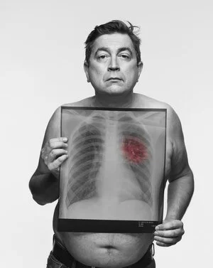 Mark, 49 / Occasional smoker / Symptoms: Back pain, Breathlessness