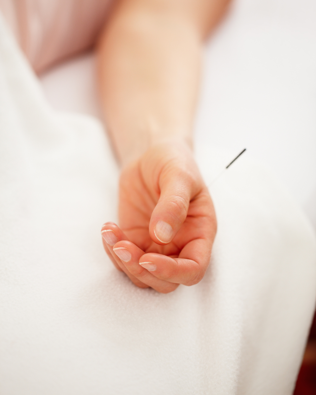 acupuncture with chiropractic in austin