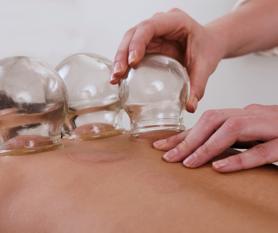 Fire cupping with chiropractic care