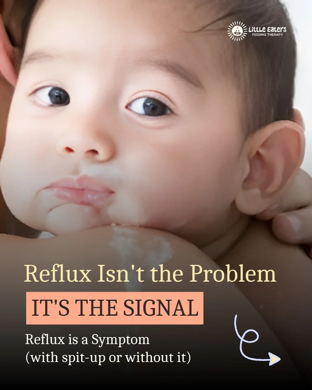I see so many babies placed on reflux meds before anyone looks at how they&rsquo;re feeding.

But reflux isn&rsquo;t the problem &mdash; it&rsquo;s the signal.

Fix the feeding, and the reflux often shifts too.

SWIPE to understand the &ldquo;why&rdq