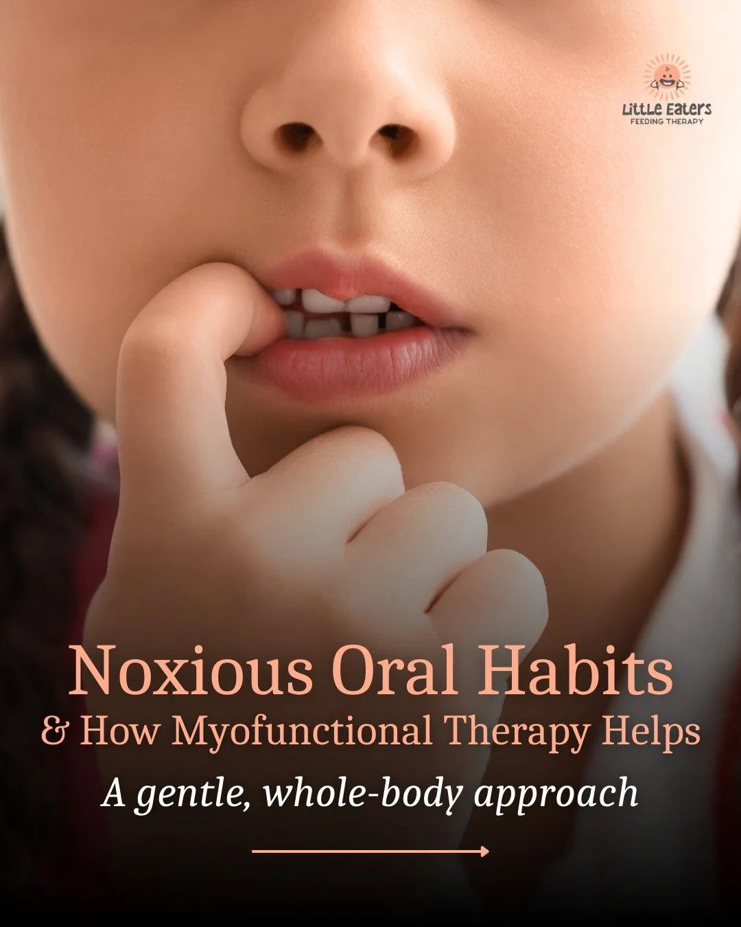 Does your child have a &ldquo;noxious&rdquo; oral habit?

Many oral habits start for comfort or regulation, but when they persist, they can impact tongue posture, jaw growth, breathing, and speech.

In myofunctional therapy, we don&rsquo;t just stop 