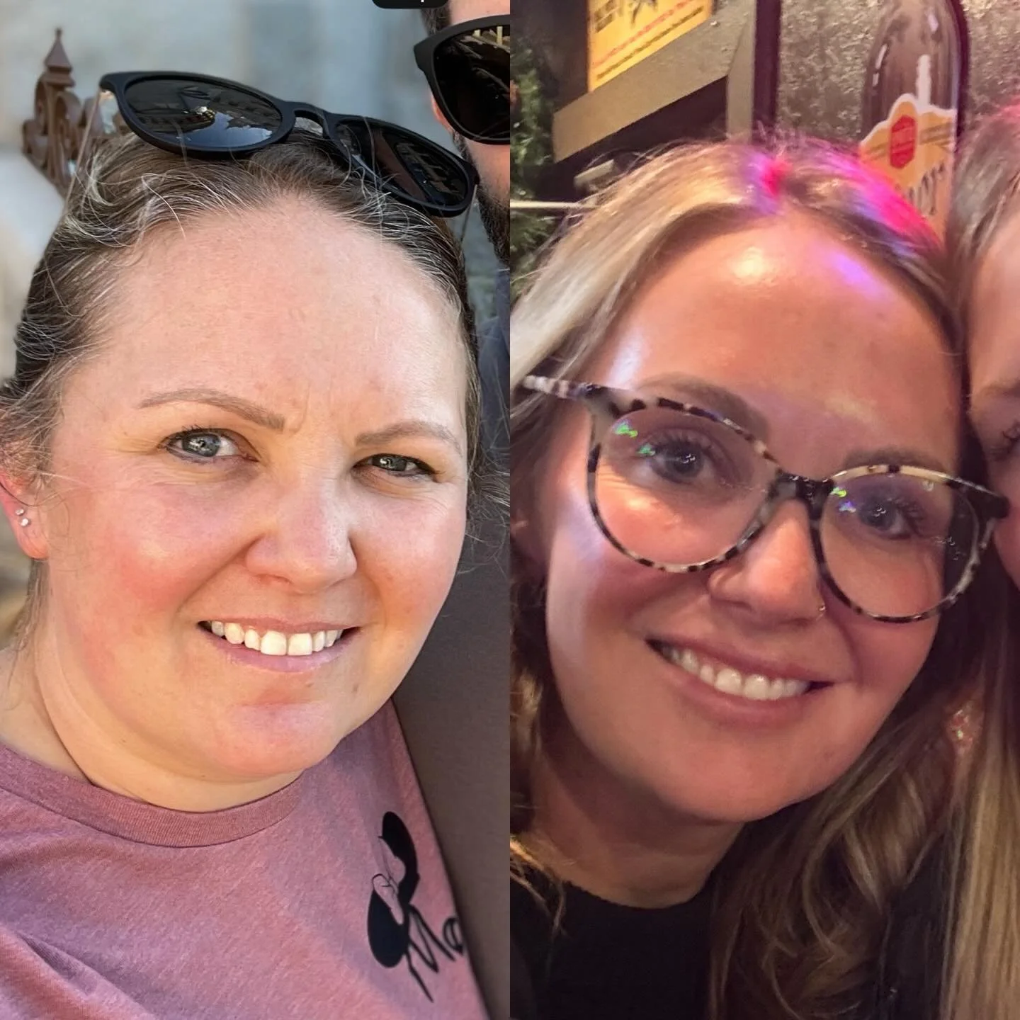Sometimes the biggest changes show up in the smallest places&mdash;like your face, your energy and your confidence (though the confidence is a big one for so many of us women)! 

A GLP-1 has been a helpful part of my weight loss journey and it&rsquo;