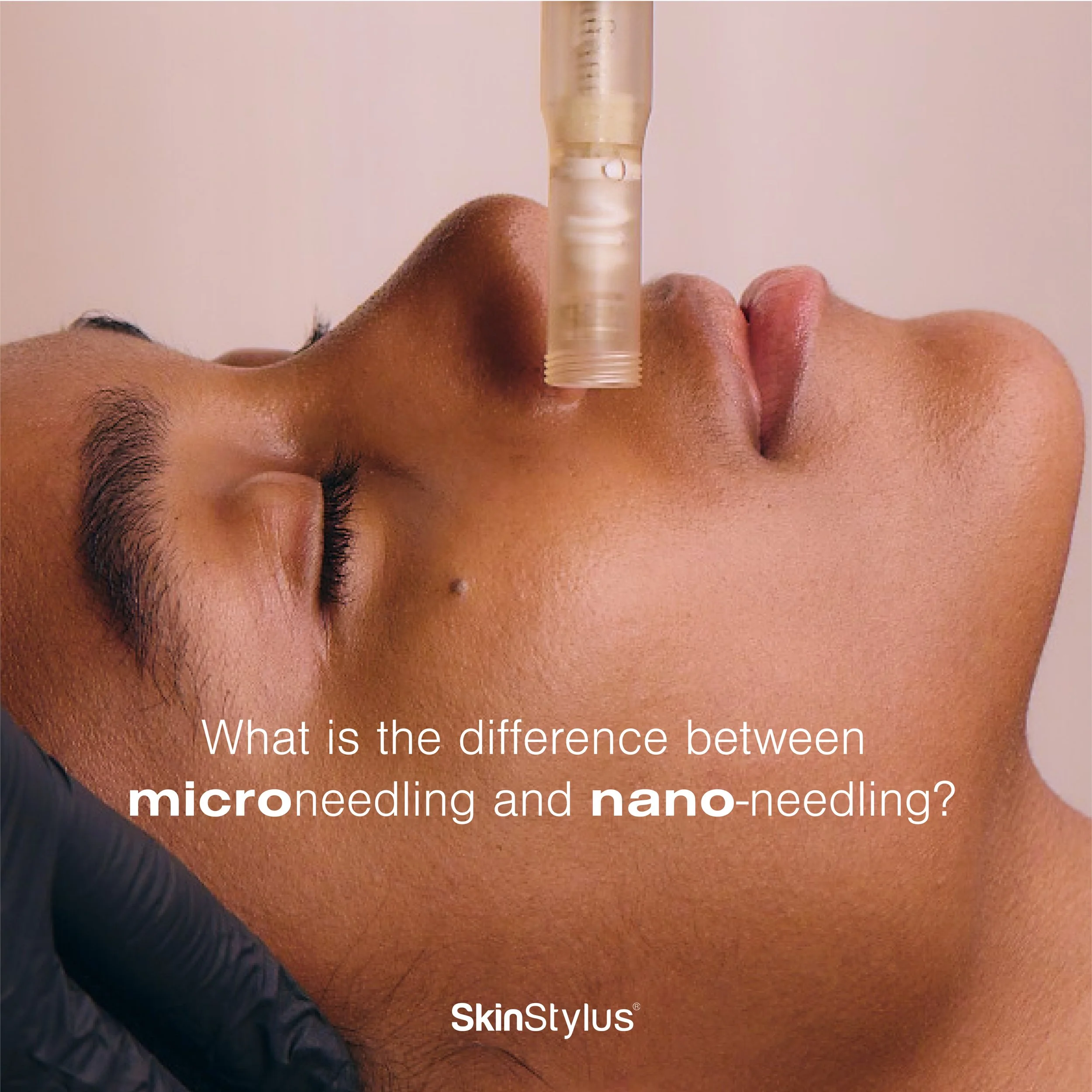 Nano Needling vs. Microneedling: Which Treatment is Right for You?