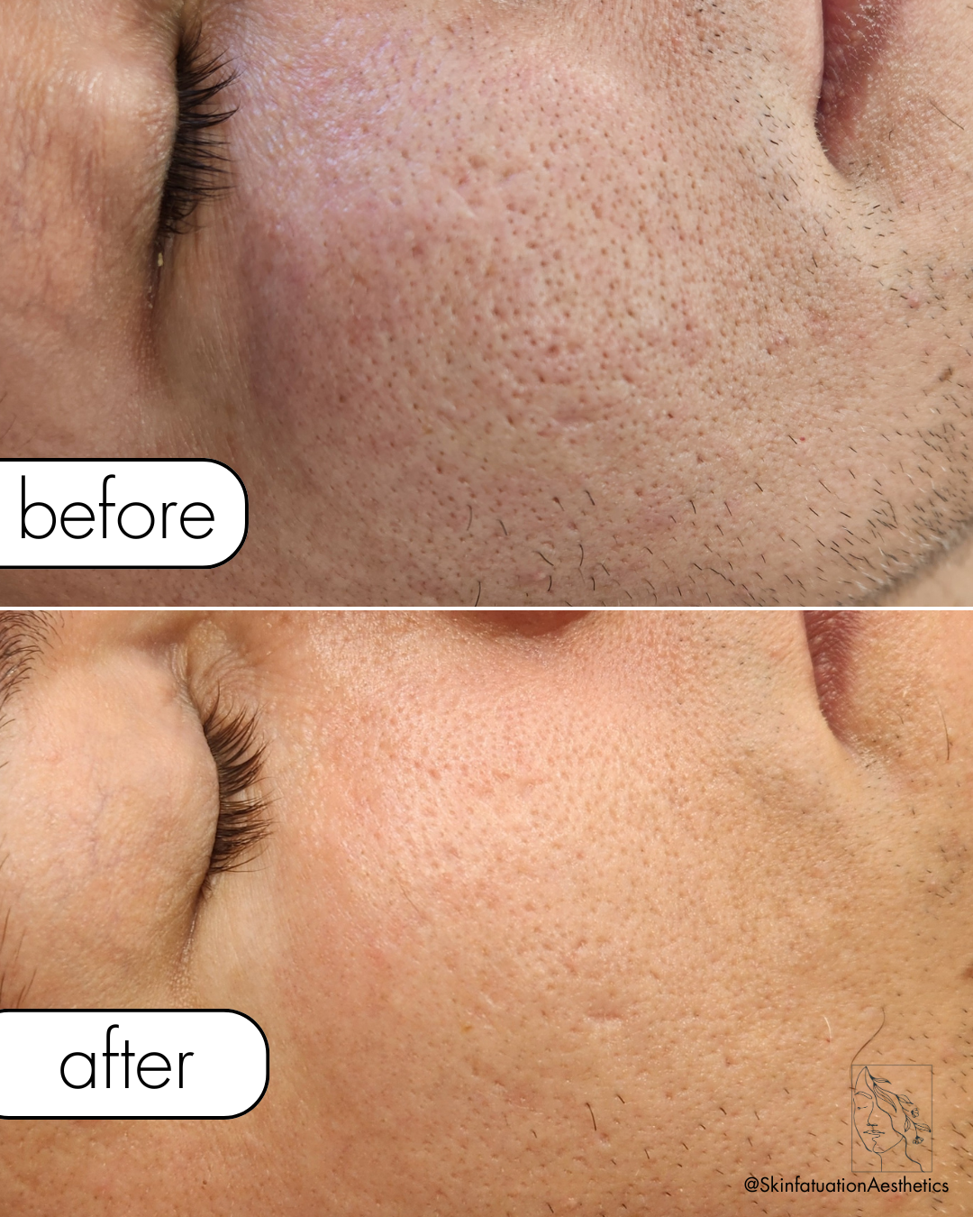 Beige Minimalist Beauty Before After Collage Instagram Post.png