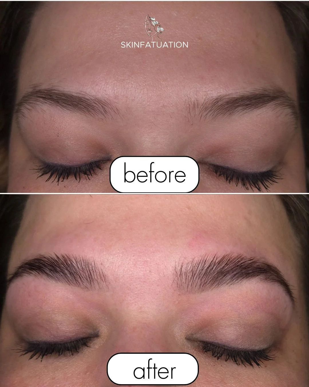 Copy of Copy of Beige Minimalist Beauty Before After Collage Instagram Post.jpg