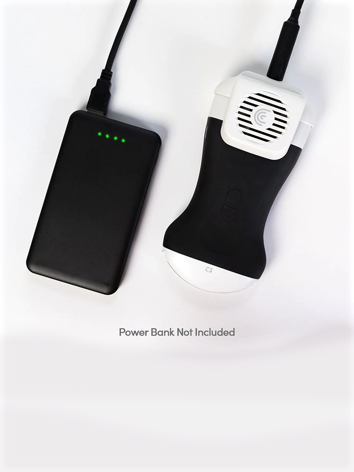 Powerfan-C3-Power-Bank-handheld-ultrasound.png