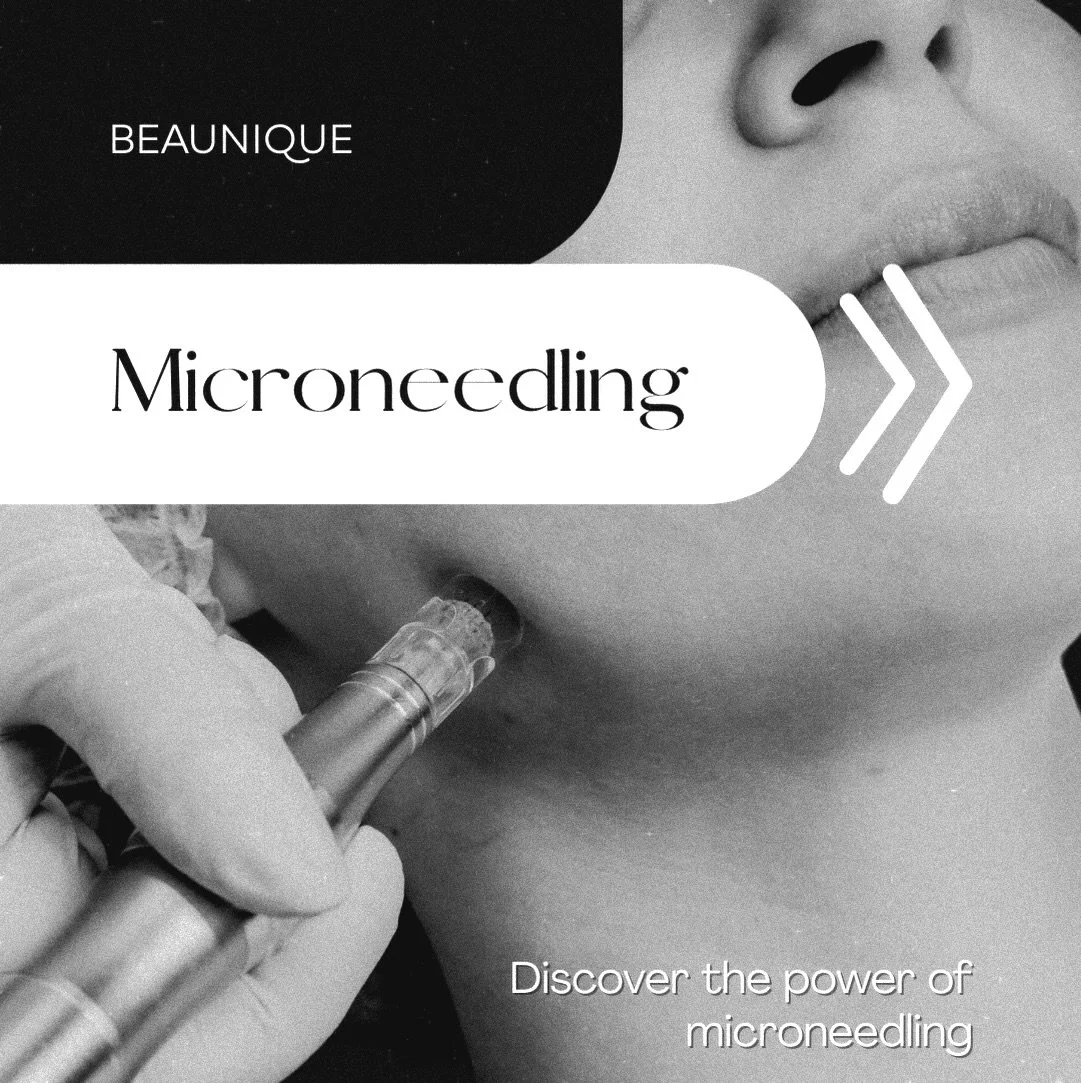 Microneedling at BEAUNIQUE&reg; ✨
A targeted skin treatment to support collagen production, refine texture and enhance natural glow.

Ideal for dull skin, fine lines, enlarged pores and post-acne marks.
Minimal downtime. Visible results.
Holistic ski