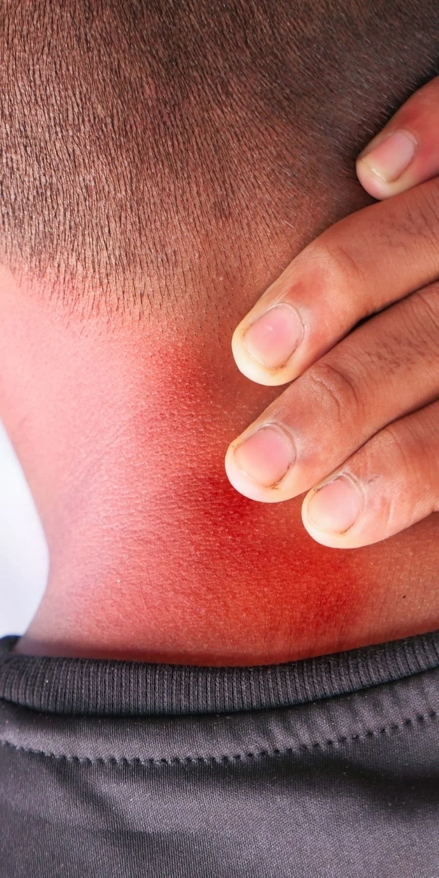 Whiplash Injury Conditions