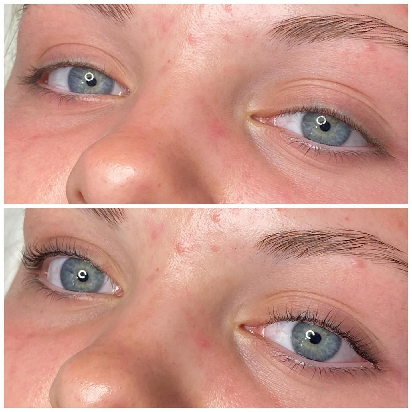 Lash Lift &amp; Tint 💕 Your own natural lashes curled. 

A lash lift lasts approximately 8 weeks and is the best summer treatment for maintenance free lashes!

For a fresh youthful appearance, give a lash lift a try!

#heidilaneesthetics #boiselashe