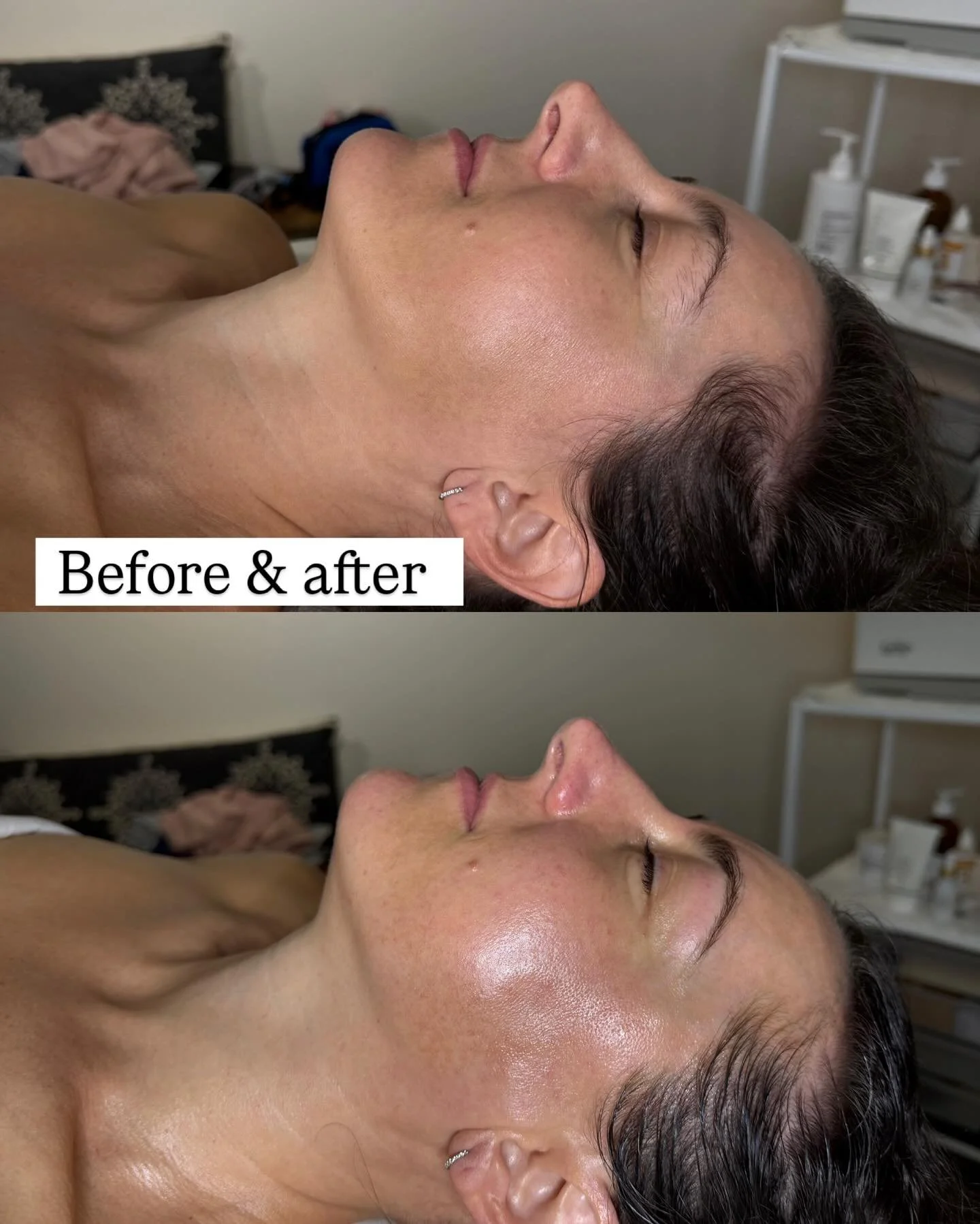 Tighter, brighter glowing skin with our Signature facial + eyebrow tint &amp; wax 💕

It's time to book your facial 🍃🍁🍂

#heidilaneesthetics #boiseidaho #boiseskincare #botniaskincare