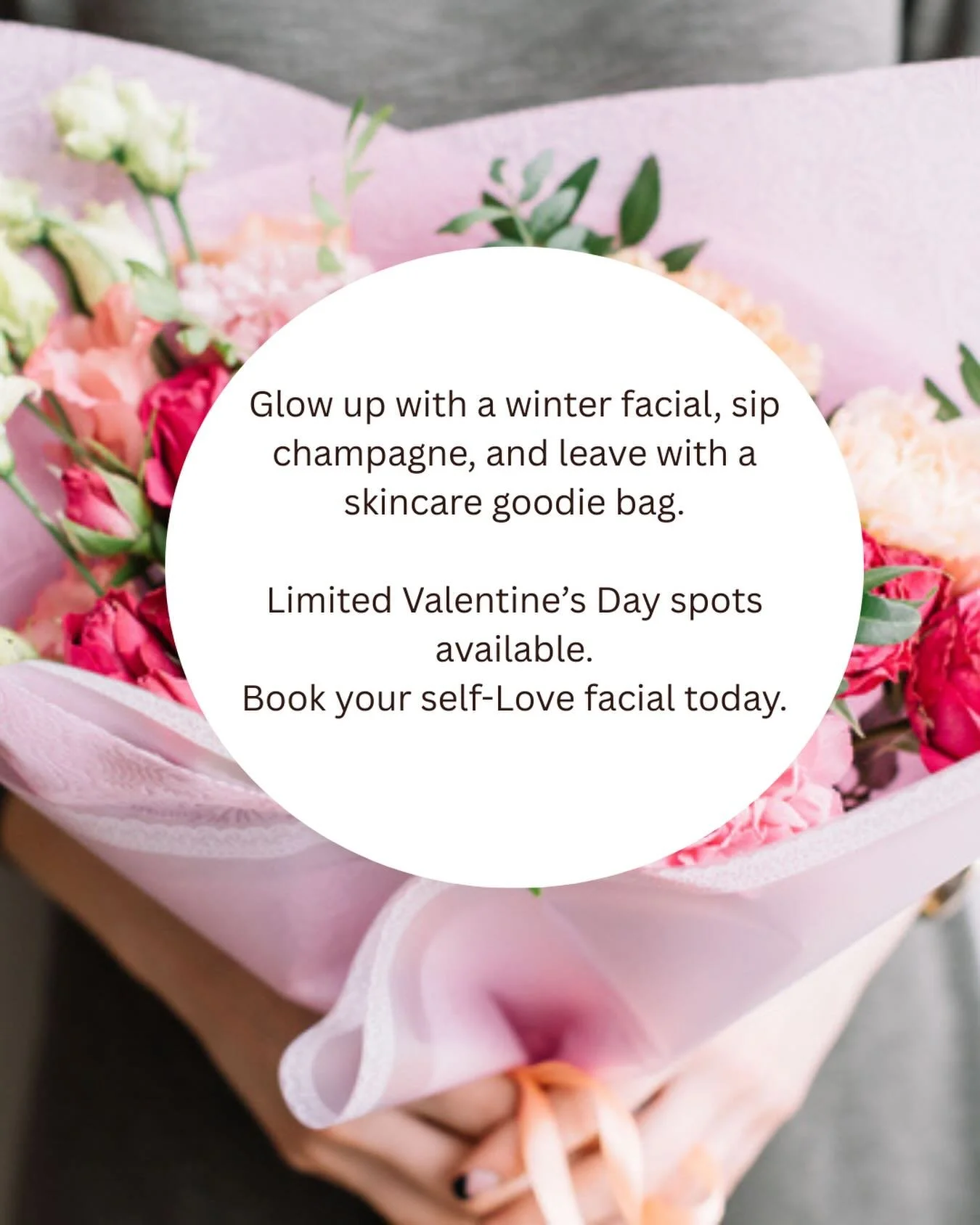 Valentine's Day is 2 weeks away 💕 Book your facial today ❤️

#heidilaneesthetics #facialsboise #boisespa #treasurevalleyidaho #boisevalentines