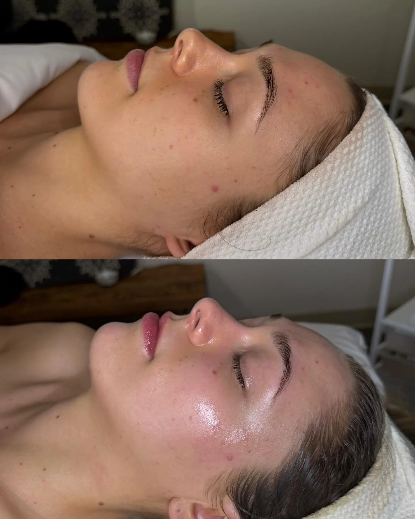 When your skin needs a reset ✨ Our Signature facial - dermaplaning included is the one 💕

Skin leaves hydrated, smooth and glowing in the most natural way 🌱

Healthy Skin. Real Results.
Book your glow today ✨

#heidilaneesthetics #botniaskincare #b