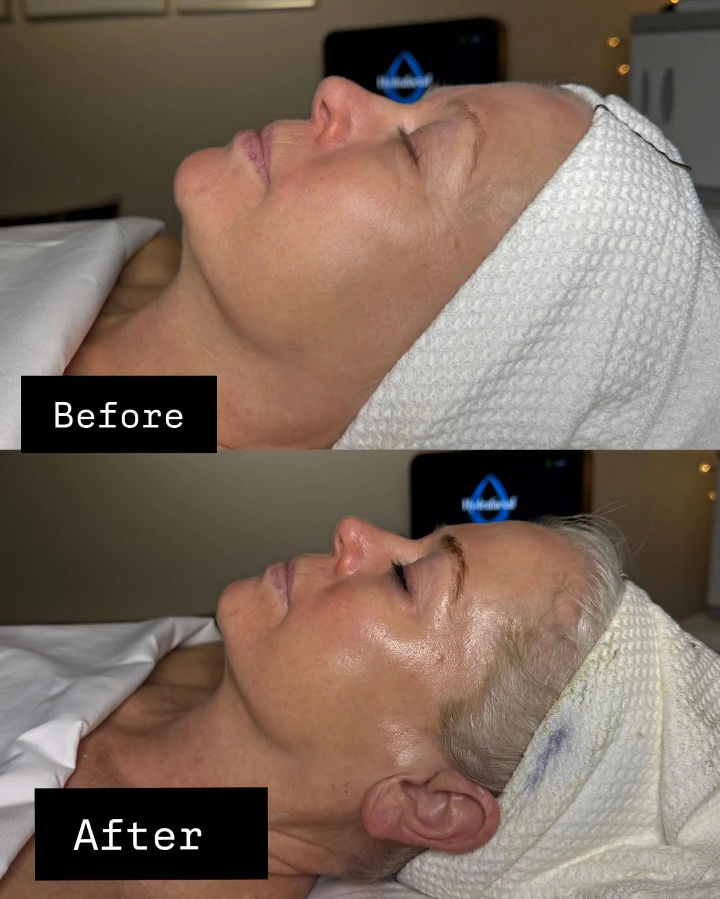 No makeup needed ⭐️ Book your Signature facial with lash &amp; brow tint for your spring refresh today 💕

#heidilaneesthetics #boisebrows #boiselashes #hydeparkboise #boisefacials