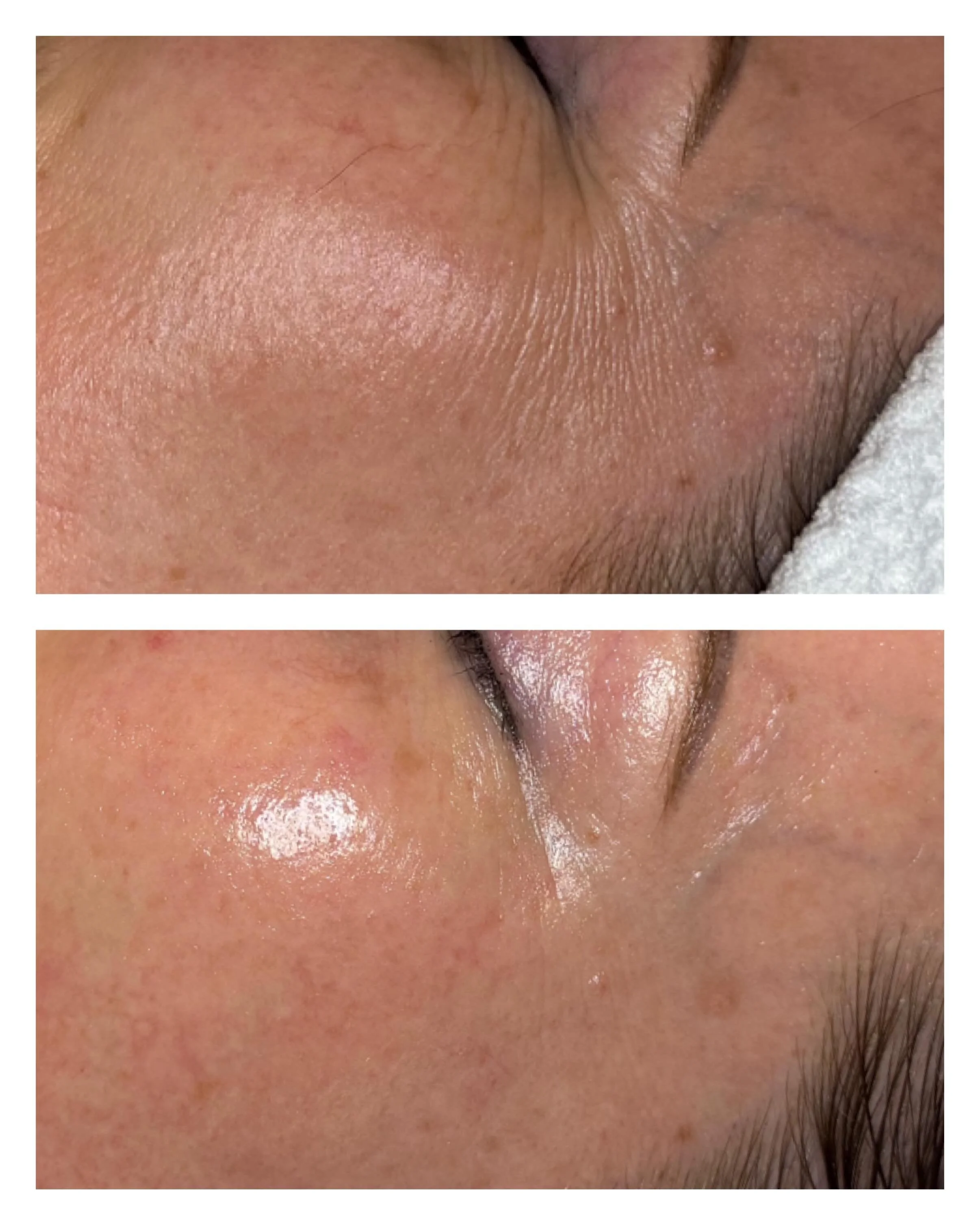 Aging concerns are not a one size fits all facial ✨ Our Signature facial is completely customized to your skin goals + what your skin needs that day.

For this client we focused on the eye area (her main skin concern) and the results speak for themse