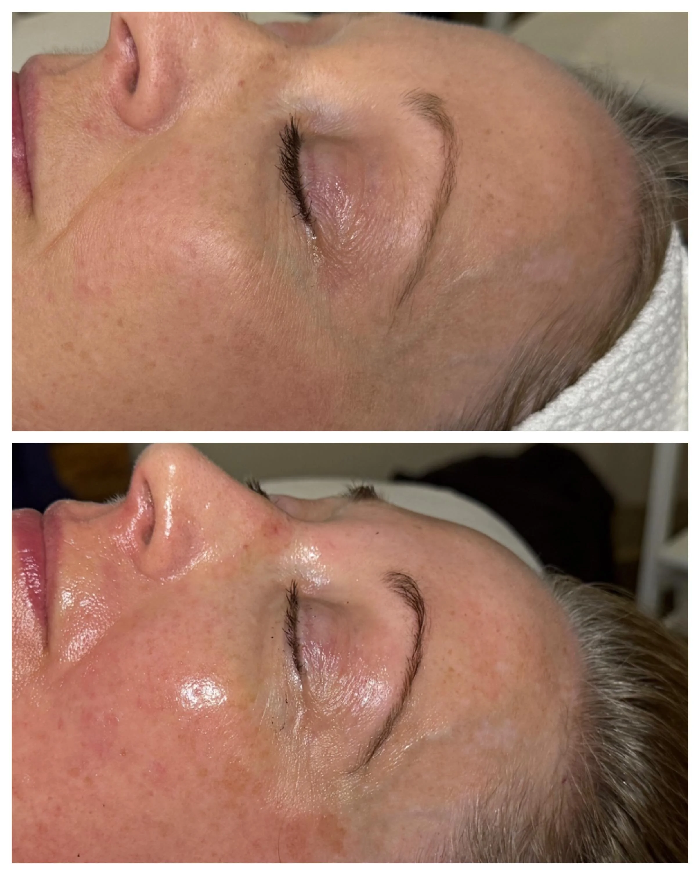 Signature Facial + eyebrow tint + eyebrow wax 💕

Book your facial today ✨ We're open all weekend + Memorial Day 🎊

#heidilaneesthetics #boisebrows #boisemoms #treasurevalleymoms #boisedayspa