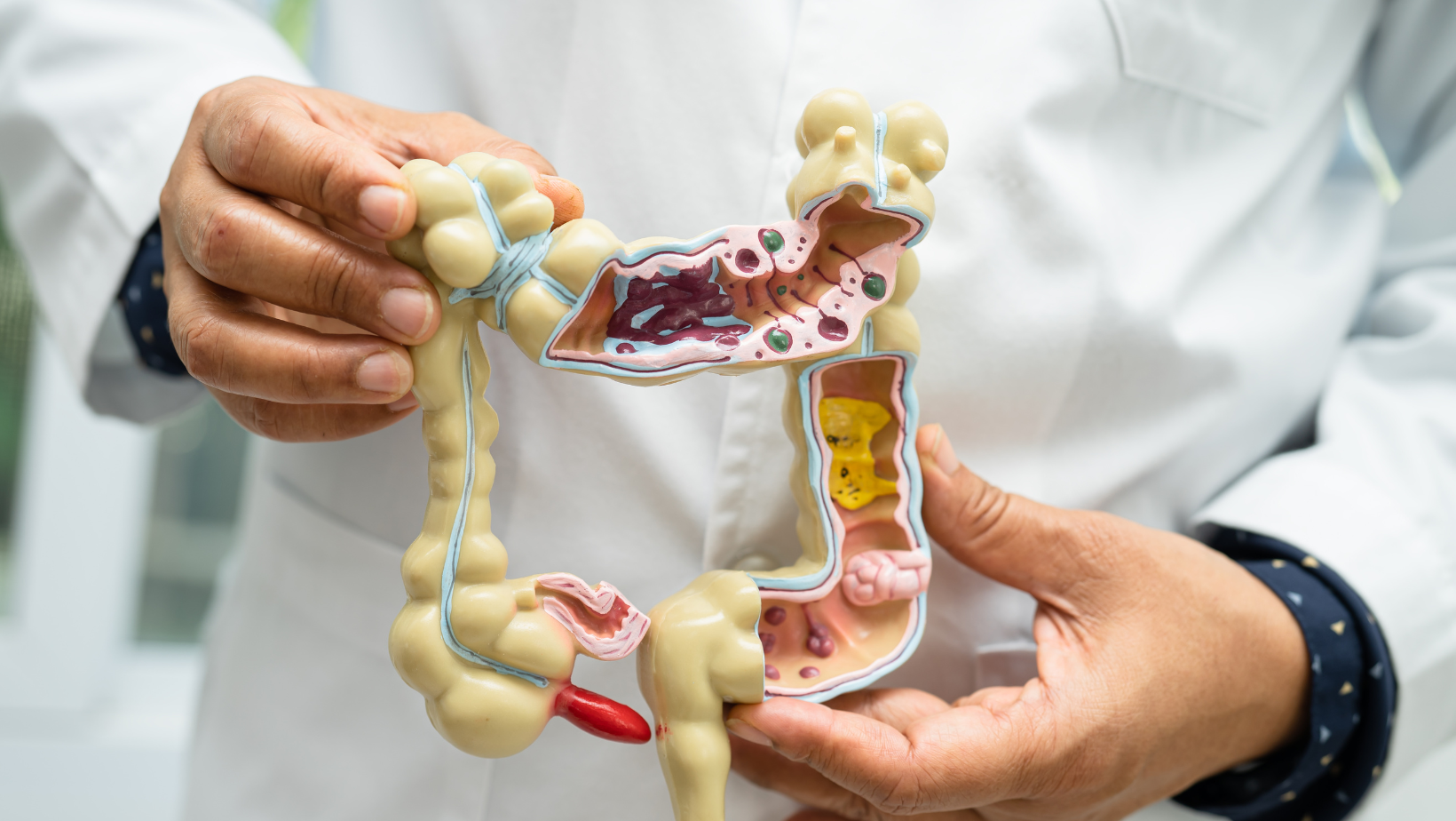 The Gut-Health Connection: How Naturopathic Gastroenterology Can Transform Your Well-Being